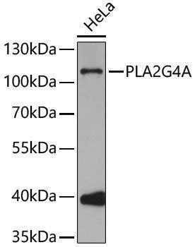 Anti-PLA2G4A Rabbit pAb