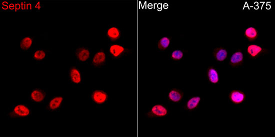 Anti-Septin 4 Rabbit pAb