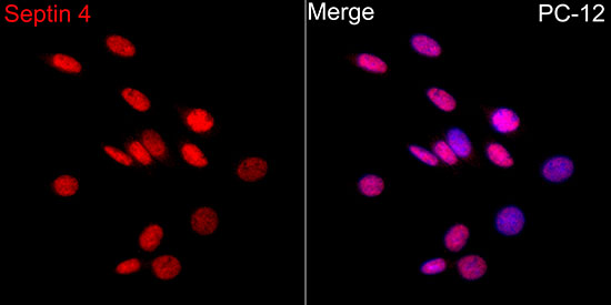 Anti-Septin 4 Rabbit pAb
