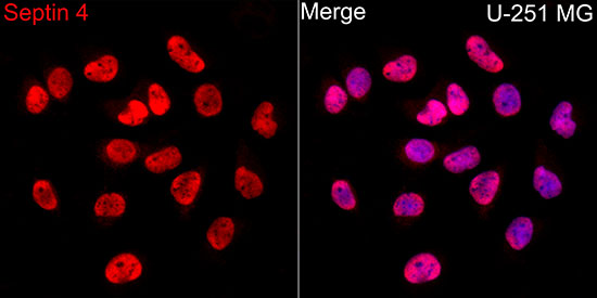 Anti-Septin 4 Rabbit pAb