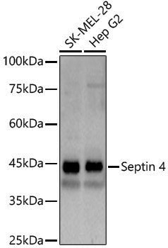 Anti-Septin 4 Rabbit pAb
