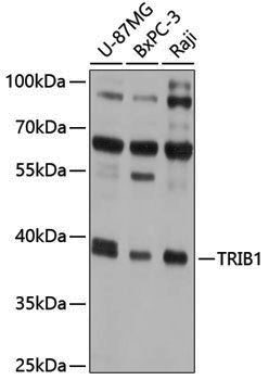 Anti-TRIB1 Rabbit pAb