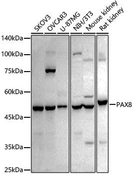 Anti-PAX8 Rabbit pAb