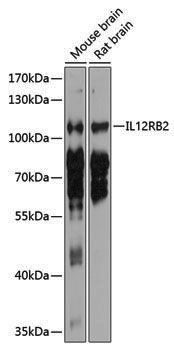 Anti-IL12RB2 Rabbit pAb