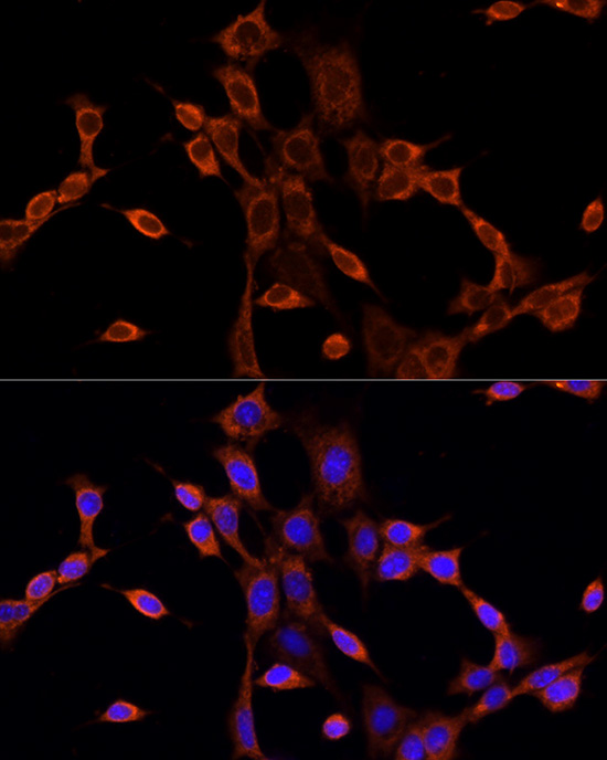 Anti-DVL1 Rabbit pAb