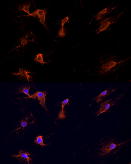 Anti-DVL1 Rabbit pAb