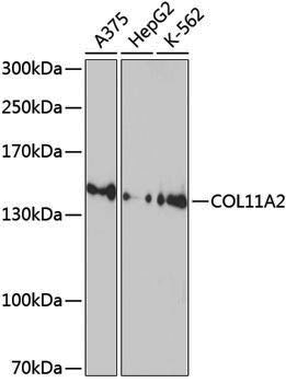 Anti-COL11A2 Rabbit pAb