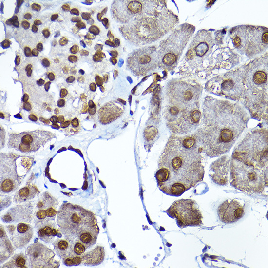 Anti-SEC14L2 Rabbit pAb