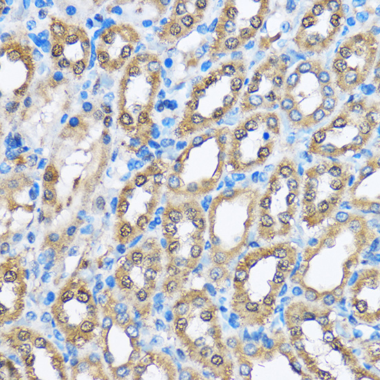 Anti-PHD2/EGLN1 Rabbit pAb