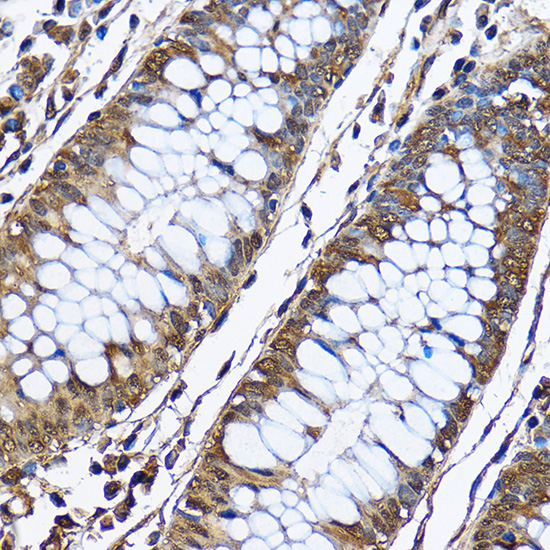 Anti-PHD2/EGLN1 Rabbit pAb