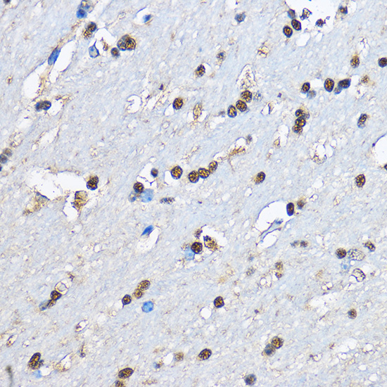 Anti-PHD2/EGLN1 Rabbit pAb