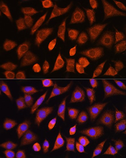 Anti-PHD2/EGLN1 Rabbit pAb