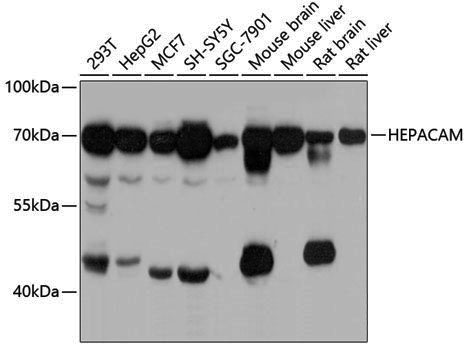 Anti-HEPACAM Rabbit pAb