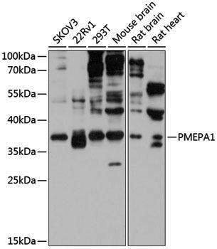 Anti-PMEPA1 Rabbit pAb