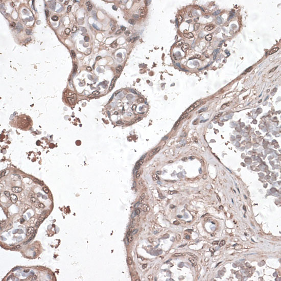 Anti-MEF2C Rabbit pAb