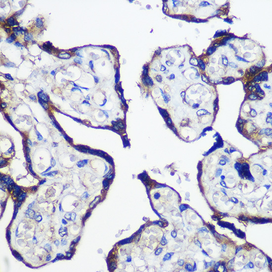 Anti-PARP8 Rabbit pAb