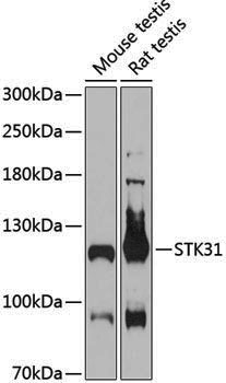 Anti-STK31 Rabbit pAb