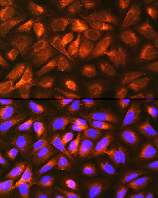 Anti-LRPAP1 Rabbit pAb
