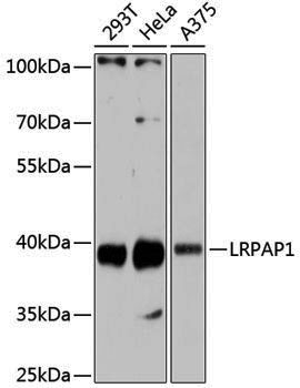 Anti-LRPAP1 Rabbit pAb