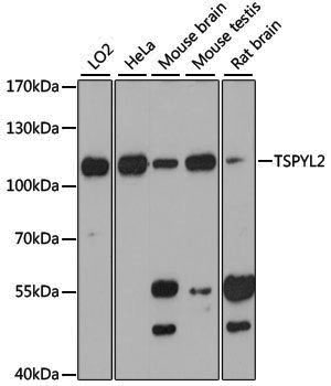 Anti-TSPYL2 Rabbit pAb
