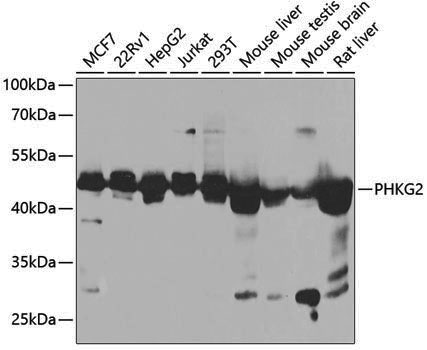 Anti-PHKG2 Rabbit pAb