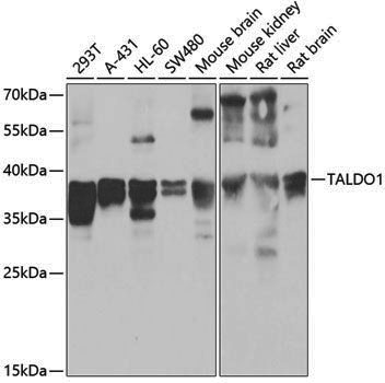 Anti-TALDO1 Rabbit pAb