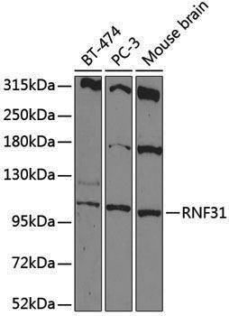 Anti-RNF31 Rabbit pAb