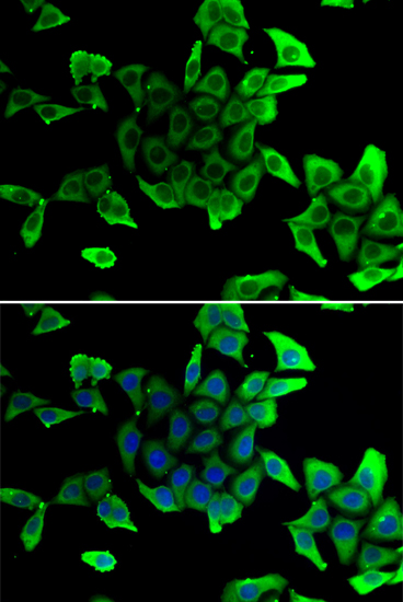 Anti-Delta-sarcoglycan/SGCD Rabbit pAb