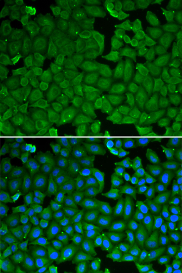 Anti-SPINK1 Rabbit pAb