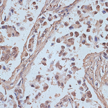 Anti-SNW1 Rabbit pAb