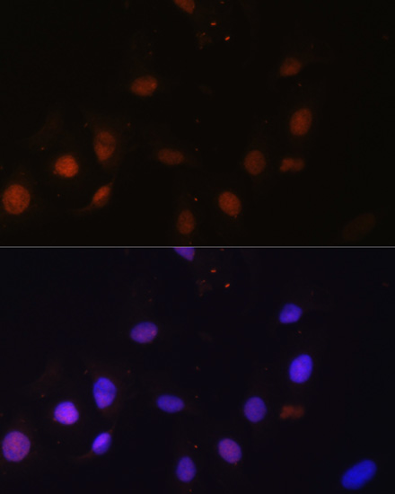 Anti-SNW1 Rabbit pAb