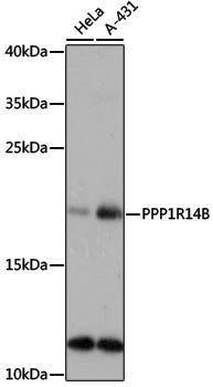 Anti-PPP1R14B Rabbit pAb
