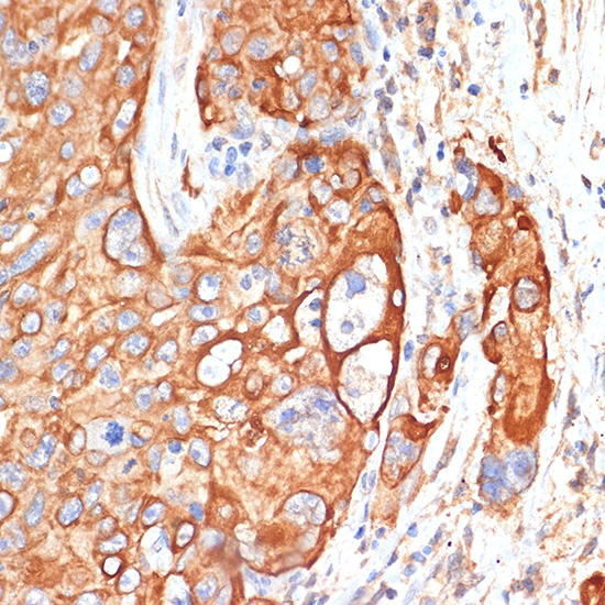 Anti-FIP200 Rabbit pAb