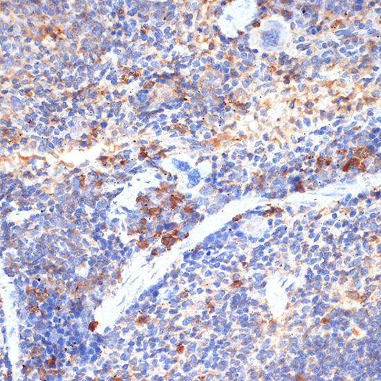 Anti-FIP200 Rabbit pAb