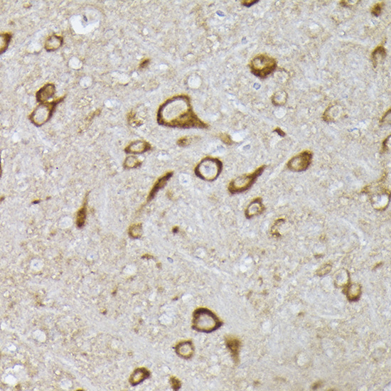 [KO Validated] Anti-PHD2/EGLN1 Rabbit pAb