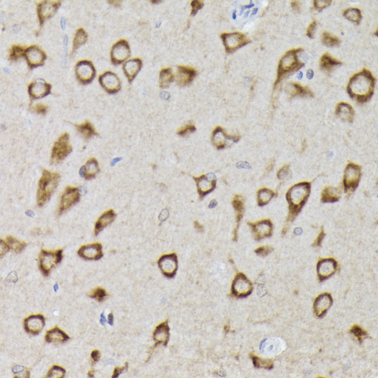 [KO Validated] Anti-PHD2/EGLN1 Rabbit pAb