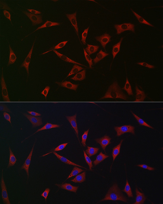 [KO Validated] Anti-PHD2/EGLN1 Rabbit pAb