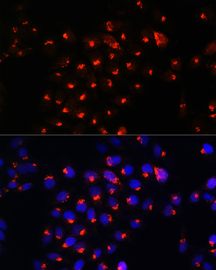 Anti-SGMS1 Rabbit pAb