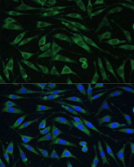 Anti-Dynamin 3 Rabbit pAb