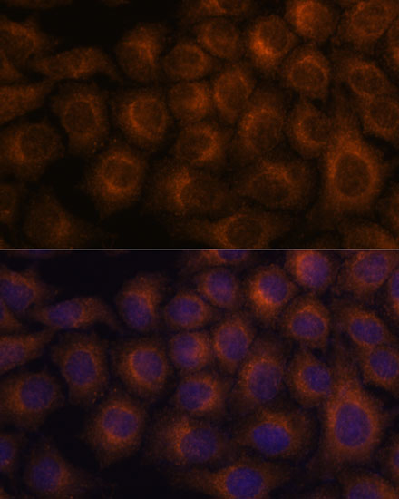 Anti-VAV3 Rabbit pAb