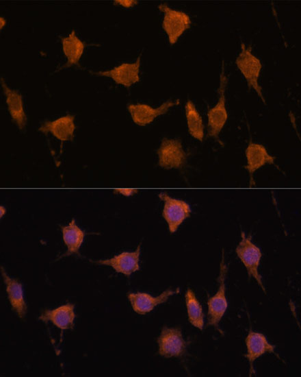 Anti-VAV3 Rabbit pAb