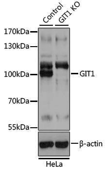 [KO Validated] Anti-GIT1 Rabbit pAb