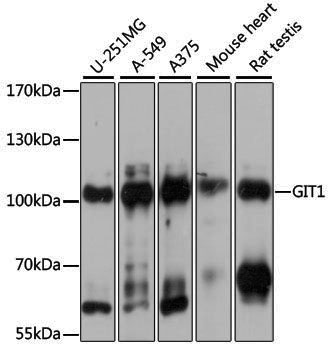 [KO Validated] Anti-GIT1 Rabbit pAb