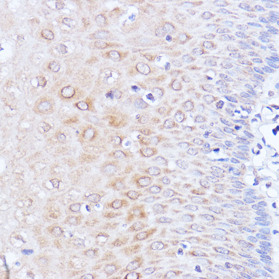 Anti-pAbPC1 Rabbit pAb