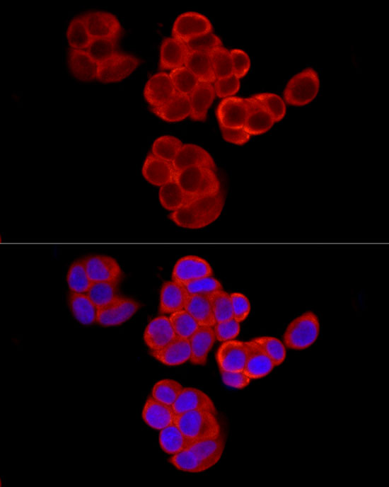 Anti-pAbPC1 Rabbit pAb
