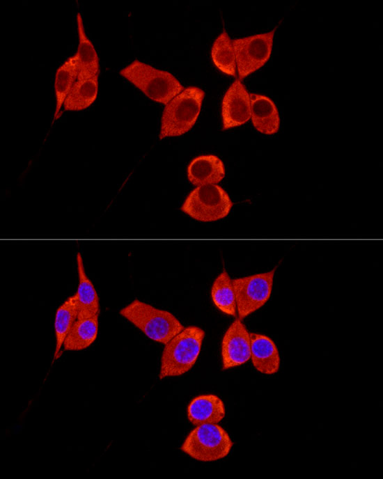 Anti-pAbPC1 Rabbit pAb