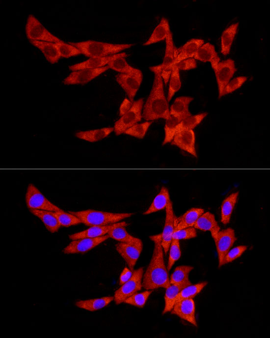 Anti-pAbPC1 Rabbit pAb