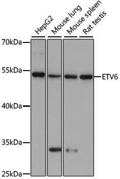 Anti-ETV6 Rabbit pAb