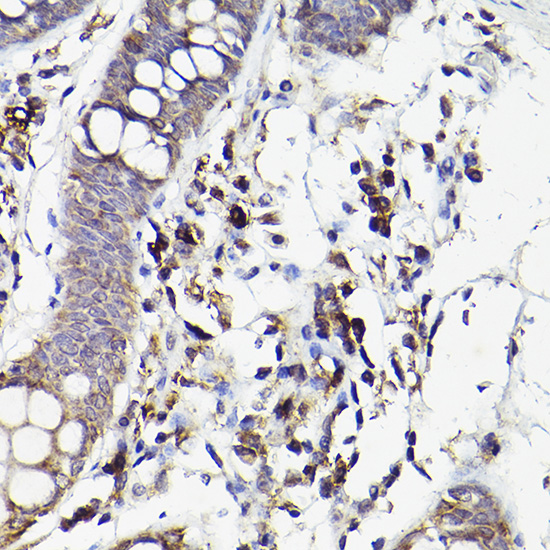 Anti-IL6R Rabbit pAb