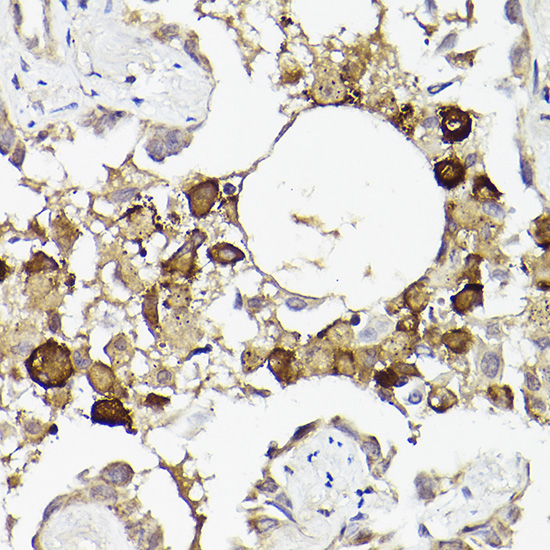 Anti-IL6R Rabbit pAb